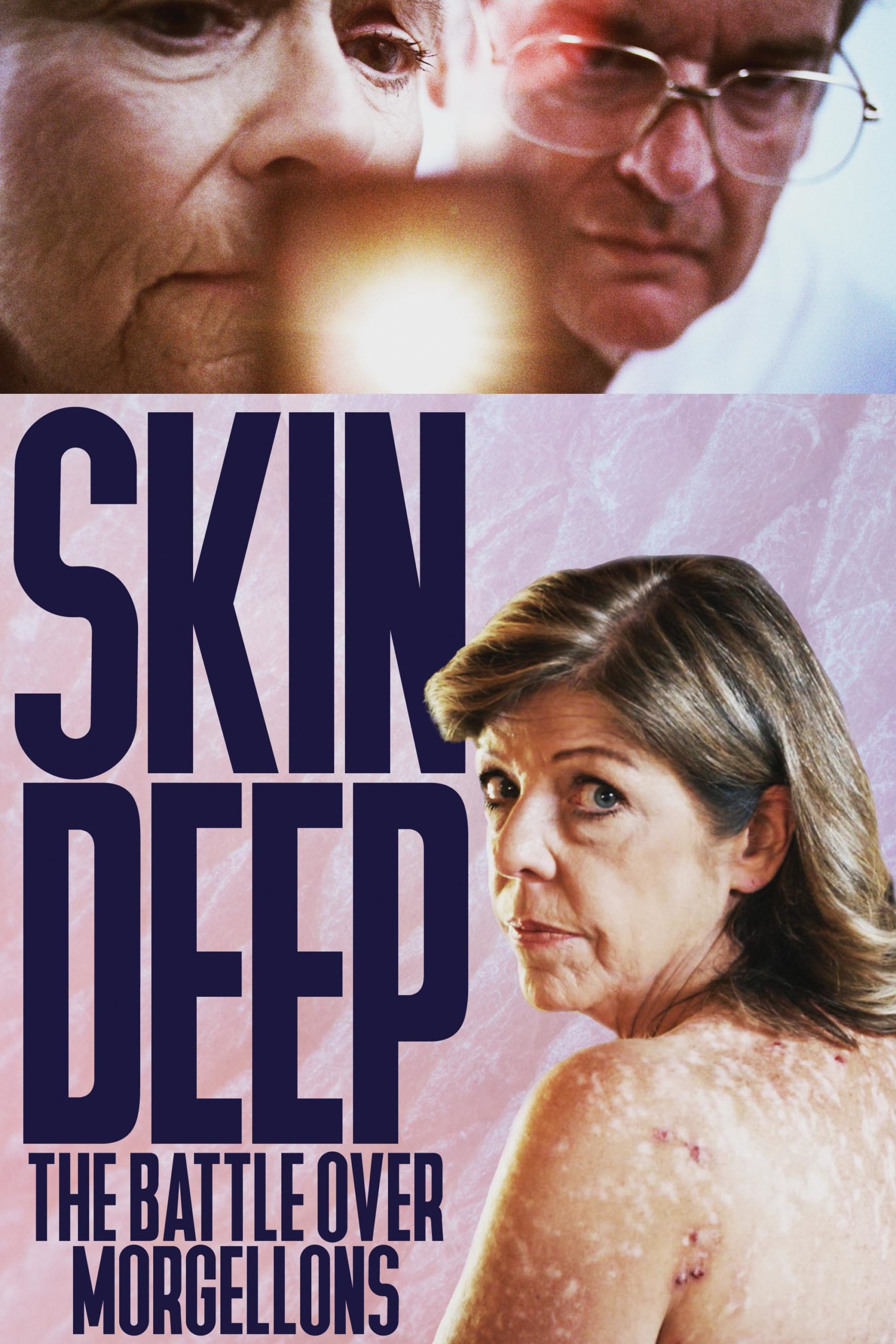 Skin Deep: The Battle Over Morgellons  (2020)